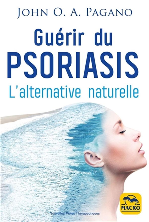 Guérir du psoriasis - L'alternative naturelle N.E.